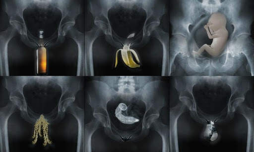 X-Ray Body Scanner screenshot 5