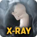 X-Ray Body Scanner 2.0.2