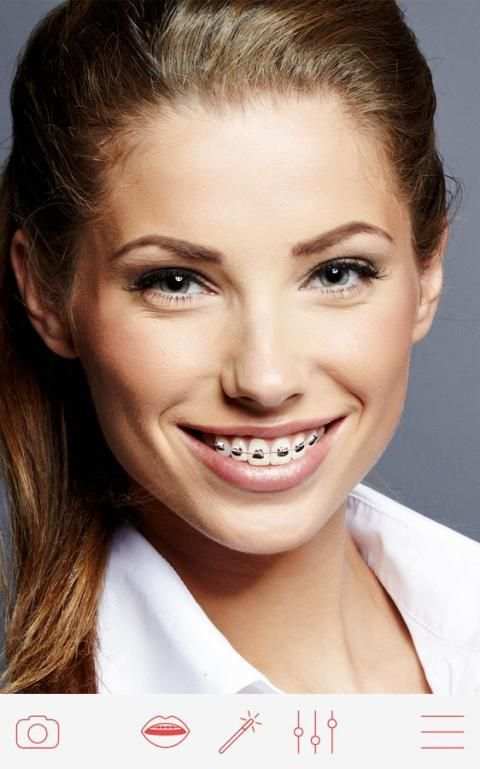 Braces 2 تصوير الشاشة