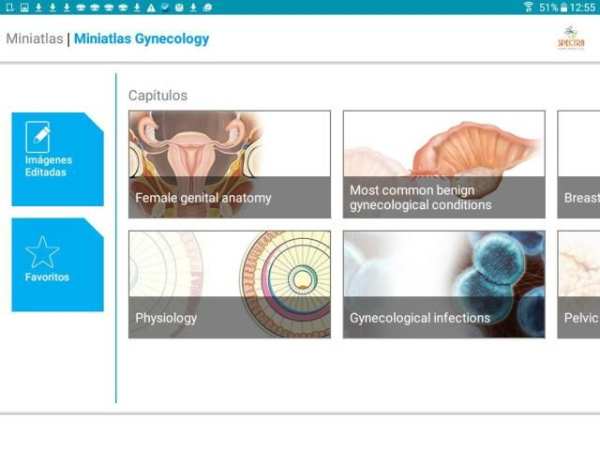 Mini Atlas Gynaecology स्क्रीनशॉट 4