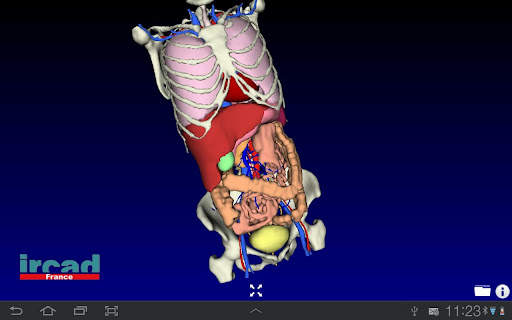 Visible Patient Lite screenshot 1