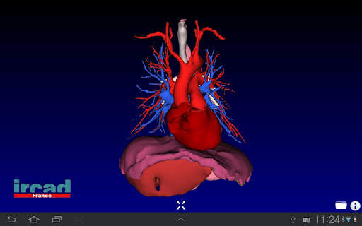 Visible Patient Lite screenshot 2