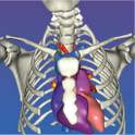 Visible Patient Lite 1.0
