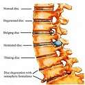 Back Pain Symptoms &amp; Treatment