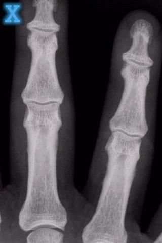 X-Ray Scanner screenshot 3