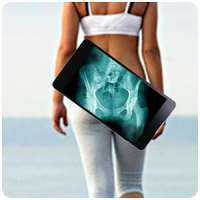 X ray Scanner Hip Bone