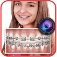 Braces Teeth Booth on 9Apps