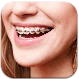 Real Braces teeth Camer Booth أيقونة