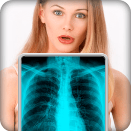 ikon Kamera X-Ray HOT