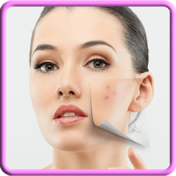 وصفات حب الشباب (بدون أنترنت) icon