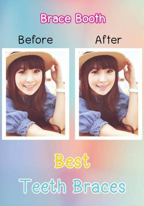 Beauty Plus Brace Camera HD 3 تصوير الشاشة