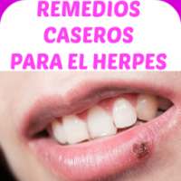 Remedios Caseros Para Herpes on 9Apps