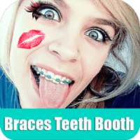 Braces Booth on 9Apps