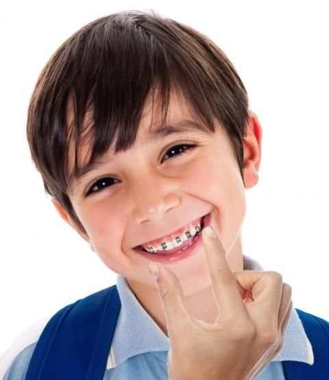 Fake Braces Photo Editor 3 تصوير الشاشة