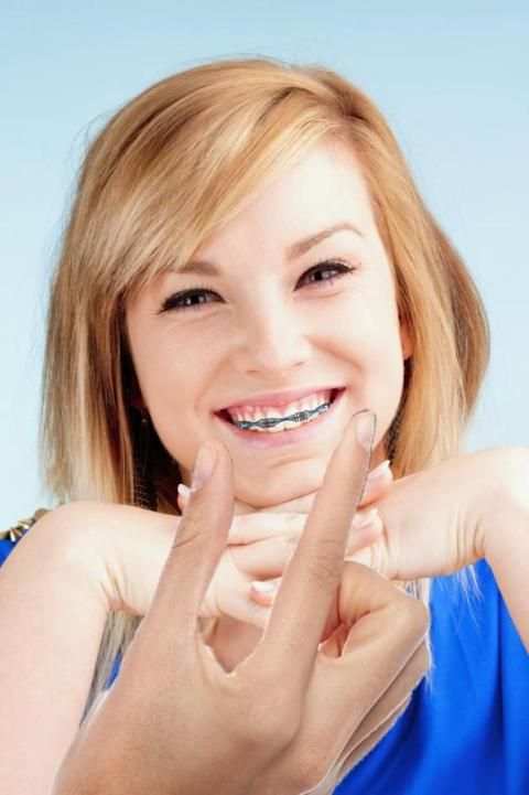 Fake Braces Photo Editor 1 تصوير الشاشة
