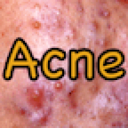 Acne Eraser icon