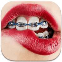 Braces Teeth Booth Pro