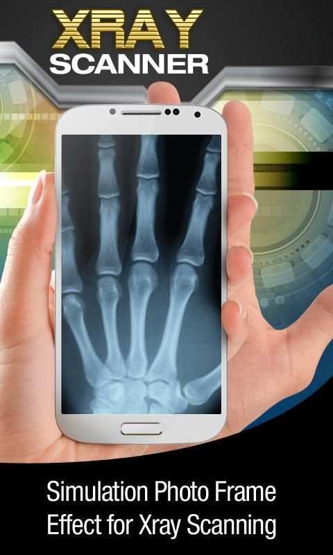 Kamera X-Ray screenshot 1