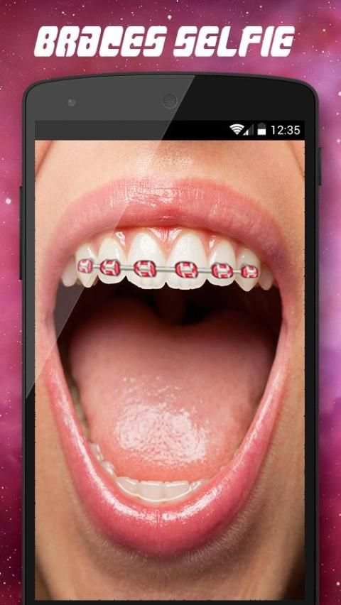 تقويم الاسنان screenshot 2
