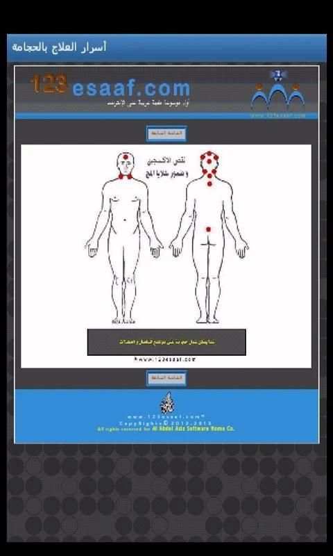 أسرار العلاج بالحجامة - تجريبى screenshot 1