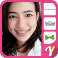 Behel Softlens Camera Cantik