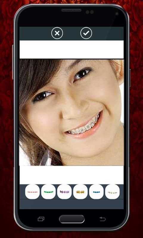 Beauty Brace Camera 2 تصوير الشاشة
