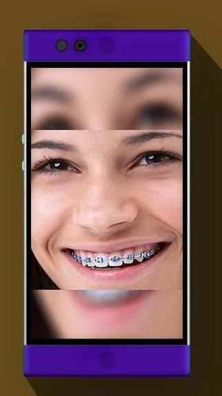 Real Braces Booth HD Studio скриншот 2