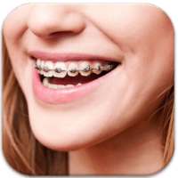 Real Braces teeth Camer Booth on 9Apps