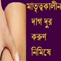 মাতৃত্বকালীন দাগ দুর করুণ