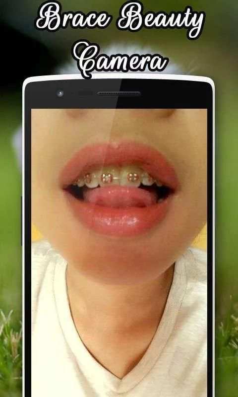 Brace Beauty Camera 3 تصوير الشاشة