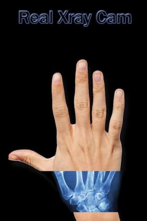 Xray Cam Real screenshot 1