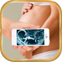 Ultrasound Scanner Prank on 9Apps