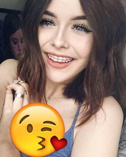Snapping Beauty Brace Camera screenshot 3