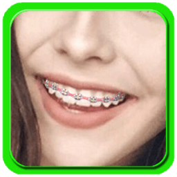 Snapping Beauty Brace Camera أيقونة