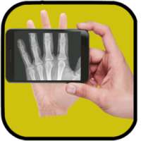 X-Ray Camera Body Scan - Prank