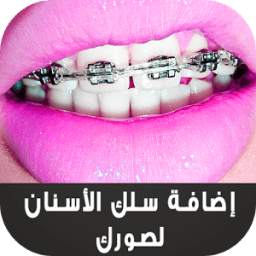 Teeth Braces 1.0