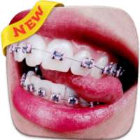 Braces Teeth Booth Pro on 9Apps