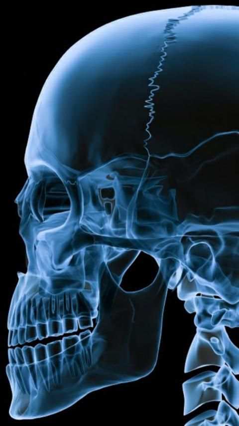 X-Ray Scanner скриншот 3