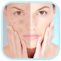 Face Blemishes Removal on 9Apps