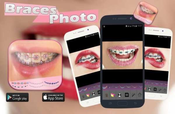 Braces Photo Booth screenshot 3