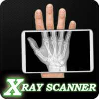 Bone X-ray prank