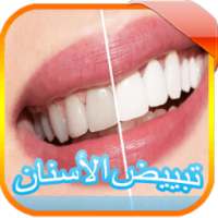 وصفات تبييض الأسنان بدون نت on 9Apps