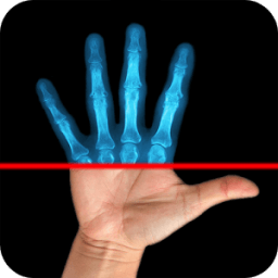 ikon Super XRay Camera