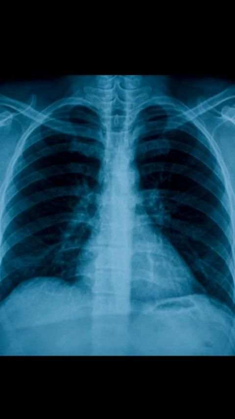 X-Ray Scanner скриншот 4