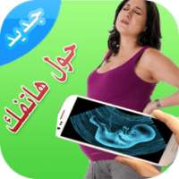 كشف الحمل بالأشعة -prank on 9Apps