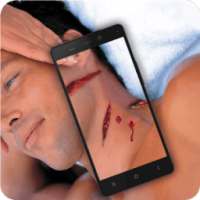 Bloody Wounds Photo PRANK