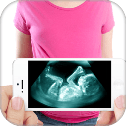 Ultrasound X-ray Scanner Prank أيقونة