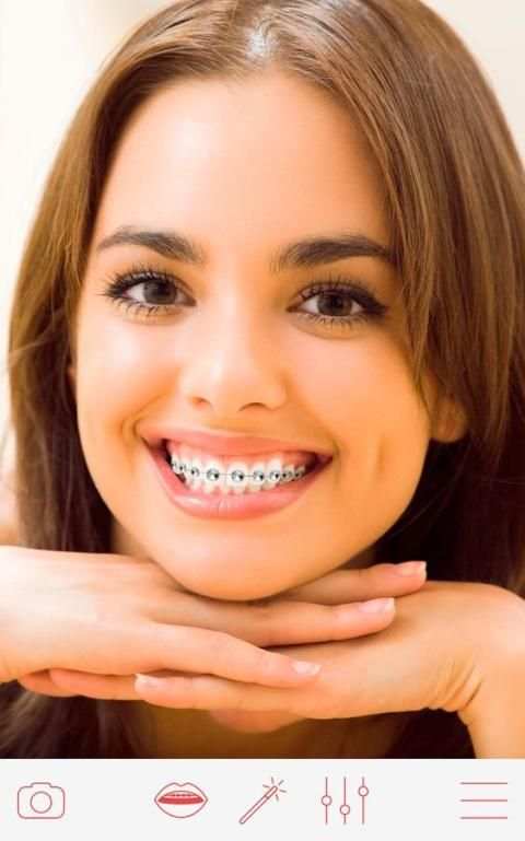 Braces 3 تصوير الشاشة