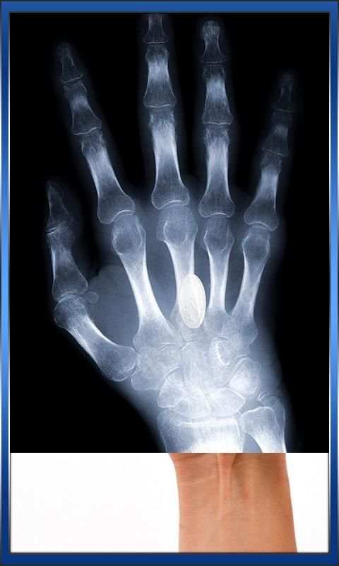 Xray Scanner Camera screenshot 9