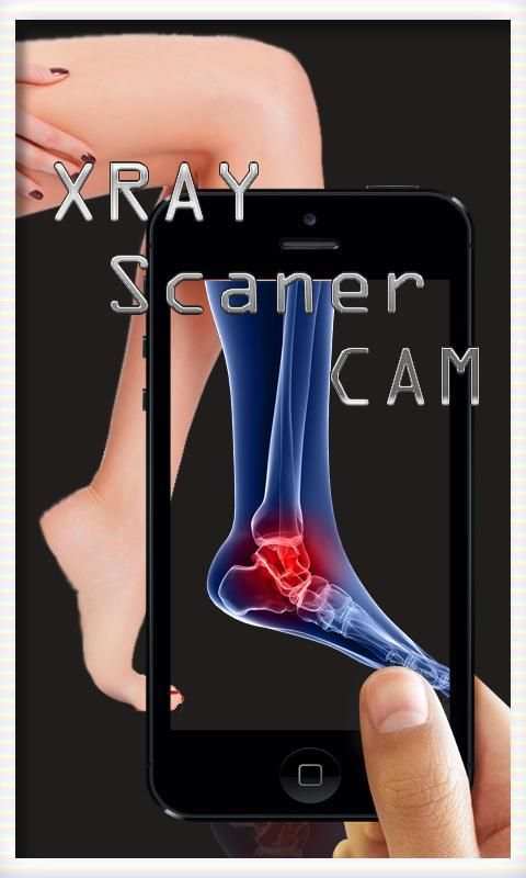 Xray Scanner Camera स्क्रीनशॉट 1